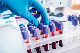Exames laboratoriais HSV SPS